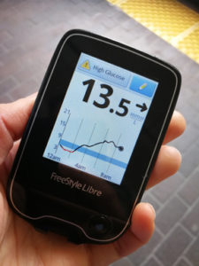 Stress causes hyperglycemia as shown on Freestyle Libre reader