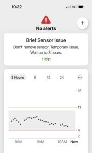 A screenshot of the Dexcom app showing "brief sensor issue"